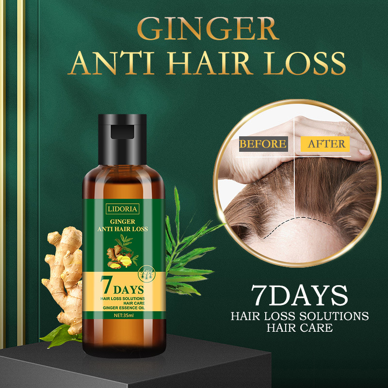 35 ml Doğal Zencefil Saç Bakım - Hair Care Essence Oil incelemesi ve fiyatı
