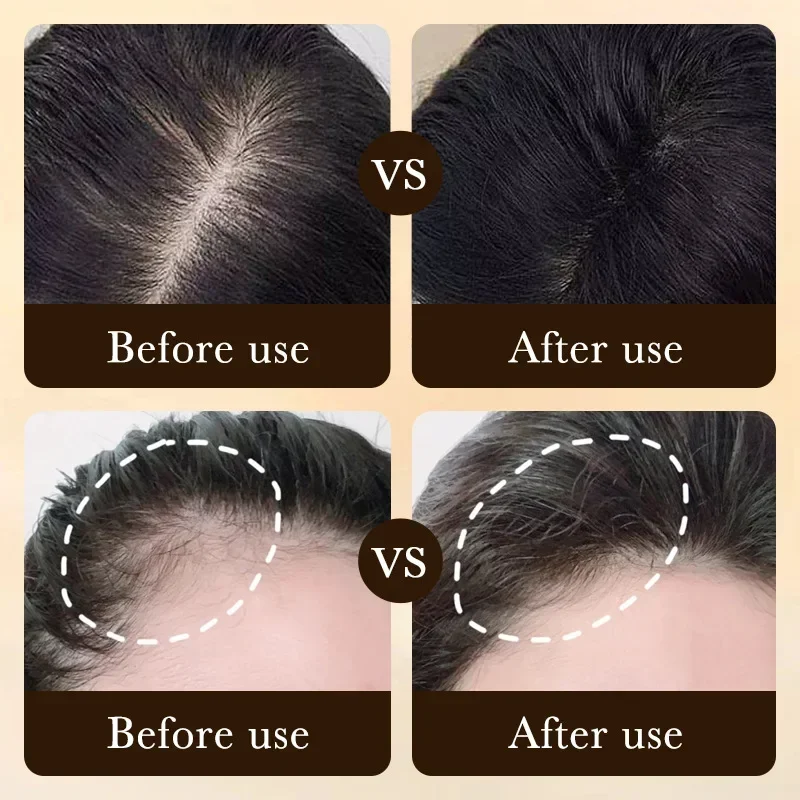 Biotin Hızlı Saç Uzatma Yağı Ü - Hair Care Essence Oil incelemesi ve fiyatı