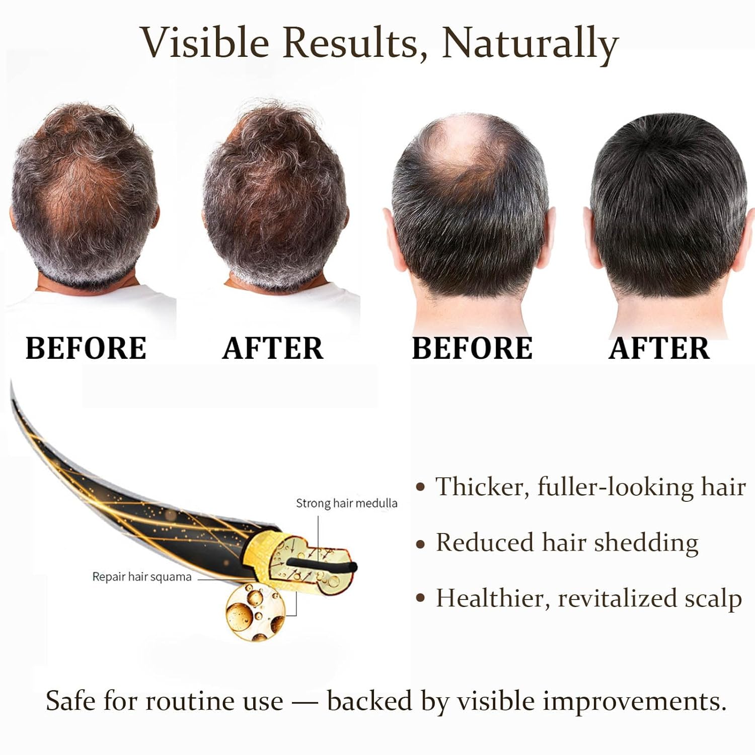 0.25mm Saç Bakım Mikro İğneli  - Hair Care Frizzy Hair incelemesi ve fiyatı
